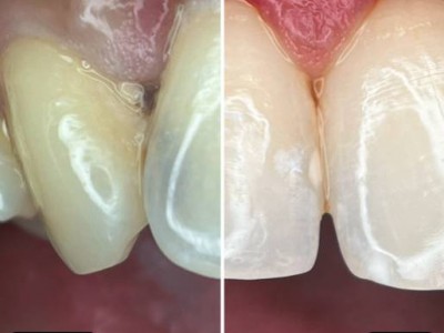 Before & After