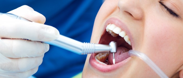 What Is Dental Implant Treatment? Is Getting Dental Implants in Turkey Advantageous?