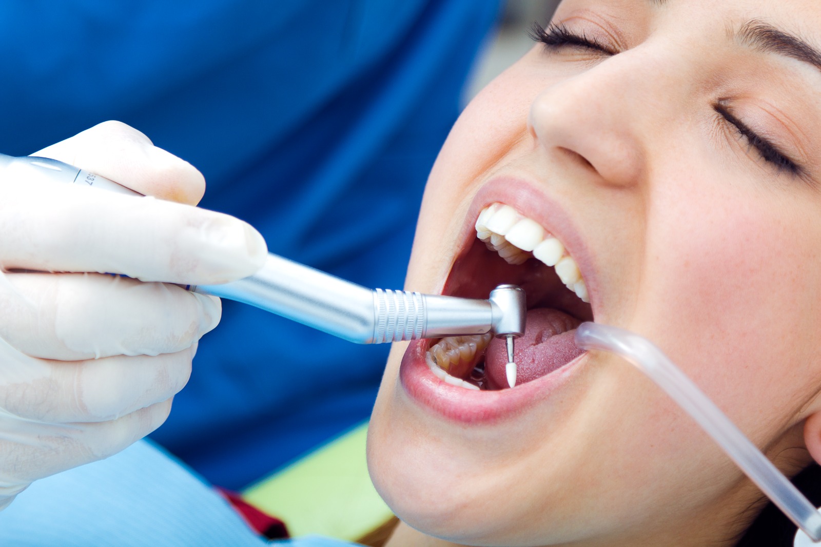  What Is Dental Implant Treatment? Is Getting Dental Implants in Turkey Advantageous? 