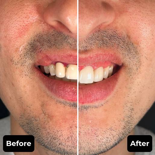 Before & After