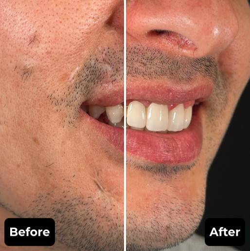Before & After