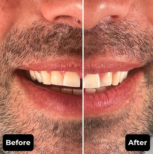 Before & After