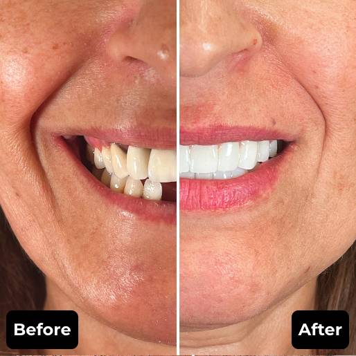 Before & After