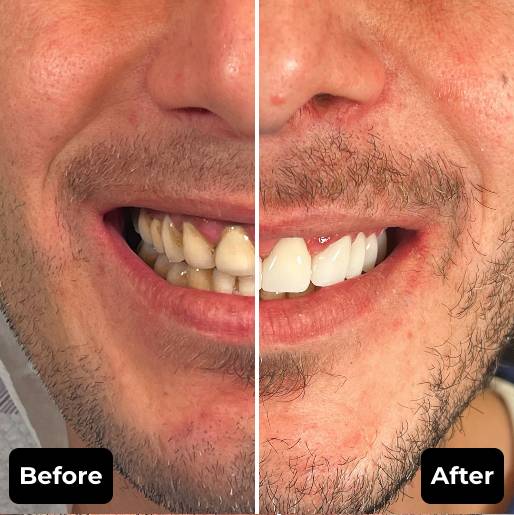 Before & After