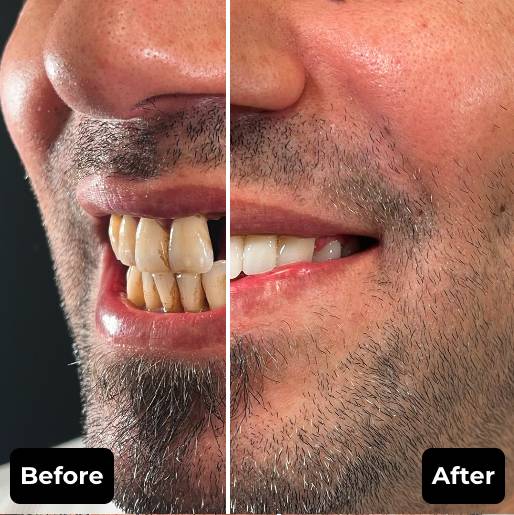 Before & After