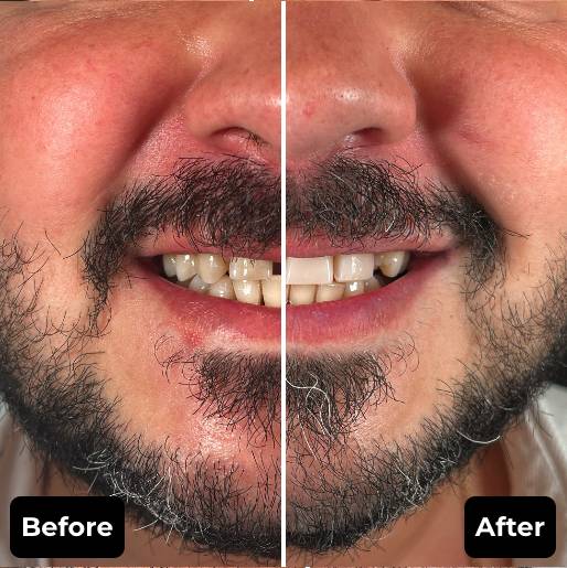 Before & After