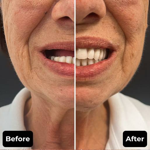 Before & After