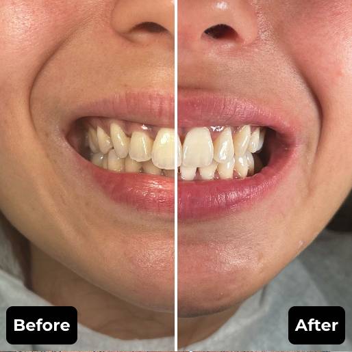 Before & After