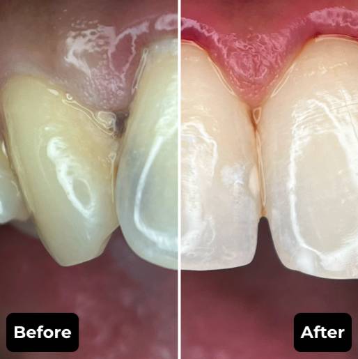 Before & After